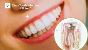 Can a Tooth Infection Kill You?