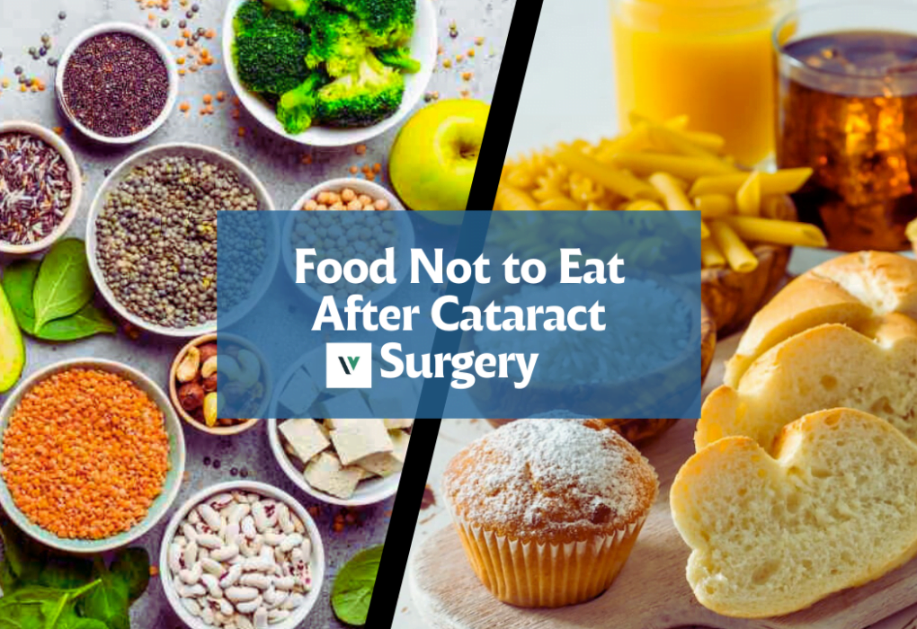 Food Not to Eat After Cataract Surgery