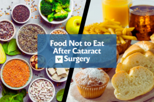 Food Not to Eat After Cataract Surgery